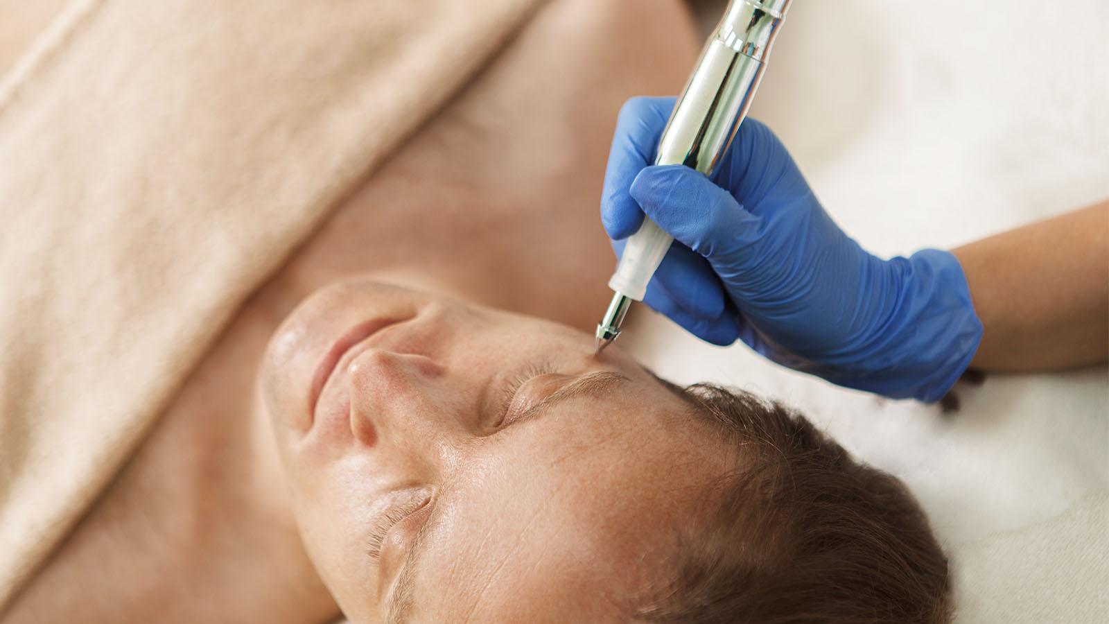 Coagulatie gezichtsbehandeling voor mannen bij Bodyland